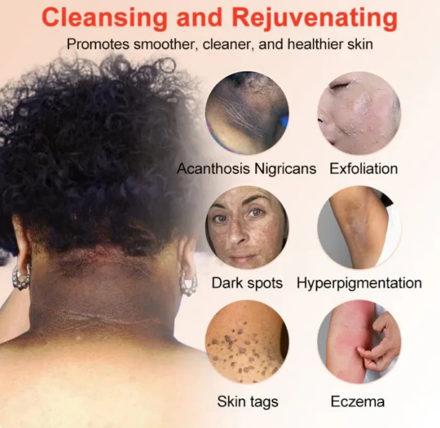 Orange Enzyme Glow Gel 😍 Dark Spot & Dead Skin Remover