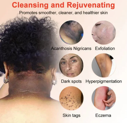 Orange Enzyme Glow Gel 😍 Dark Spot & Dead Skin Remover